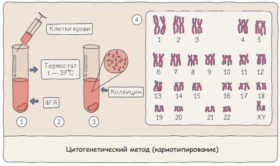 Цитогенетический метод: изучение хромосом и кариотипа под микроскопом.