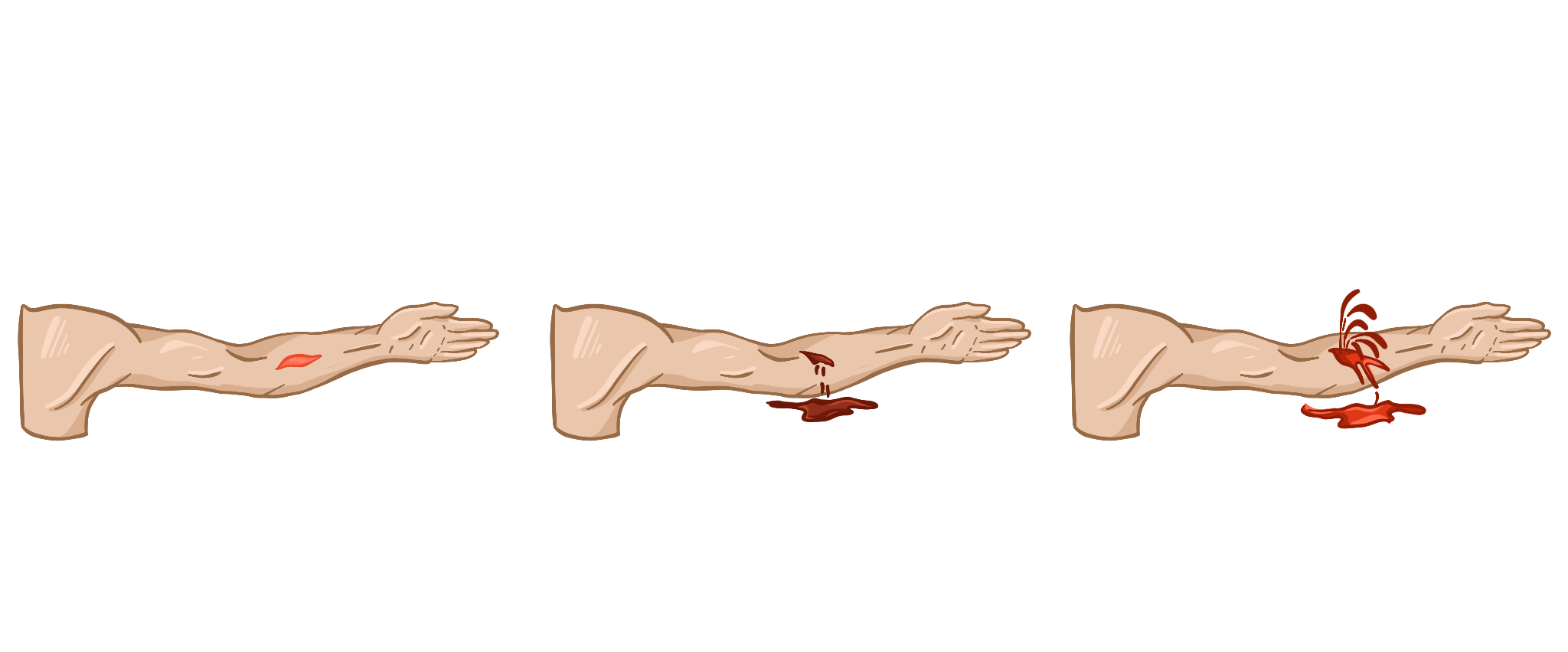 Кровотечения