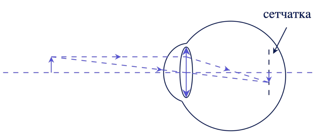 Сетчатка глаза