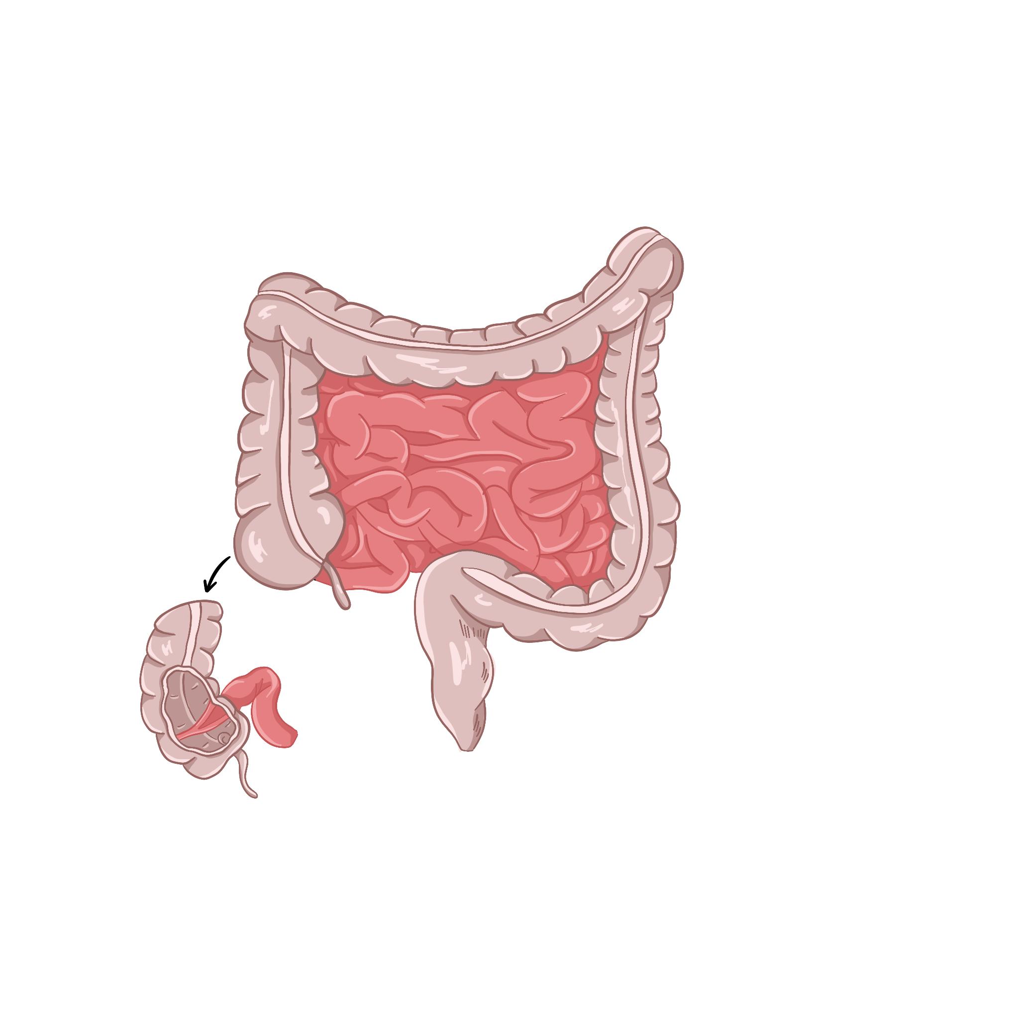 Толстый кишечник и аппендикс